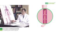 炸弹腿和静脉曲张、老烂腿是一回事吗？