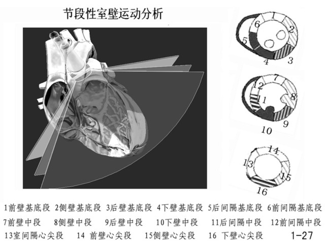 心脏解剖笔记左房左室篇