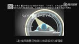 医学动画：CT检查