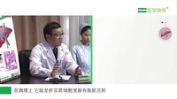 脂肪肝是怎么回事？