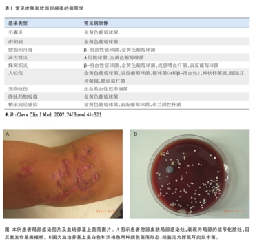 误诊为皮肤结核的豚鼠耳炎奴卡菌感染1例
